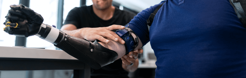 How are Bio-Robo Inter Limb Cordination in Prosthetics Improving Human Lives?