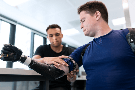 How are Bio-Robo Inter Limb Cordination in Prosthetics Improving Human Lives?